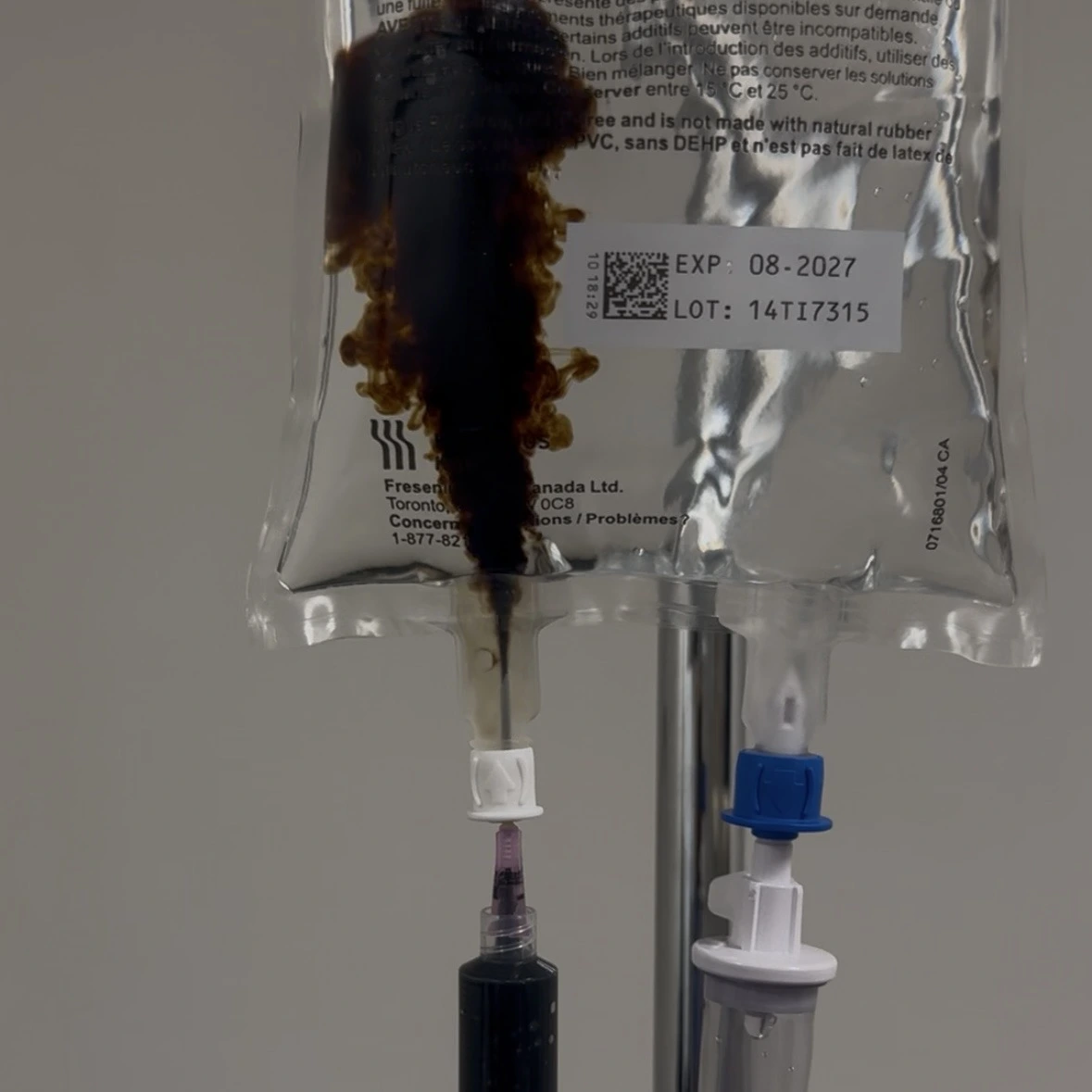 Iron IV therapy infusion for iron deficiency in Kelowna, BC